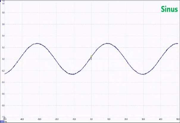 NFO Sinus